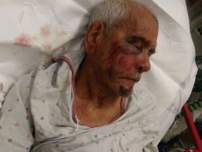 E rrahin 91 vjeçarin me tulla, i thonë të kthehet në shtetin e tij (Video)