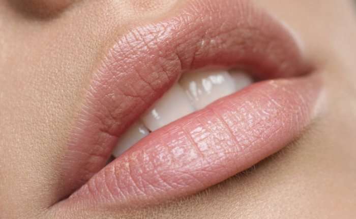 Recetë shtëpiake për shërimin e buzëve të thara