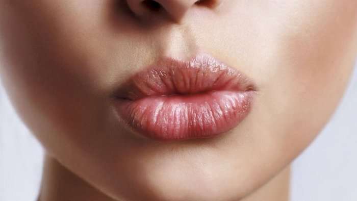 5 mënyra të thjeshta për t’i bërë buzët tuaja të plasaritura të puthshme!