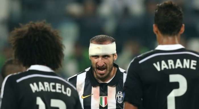 Juventusi në telashe, Chiellini në dyshim për Madridin