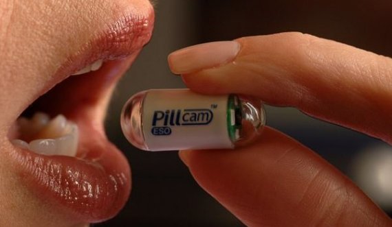  Pacientët mund të gëlltisin pilulën me kamerë për ta identifikuar kancerin 