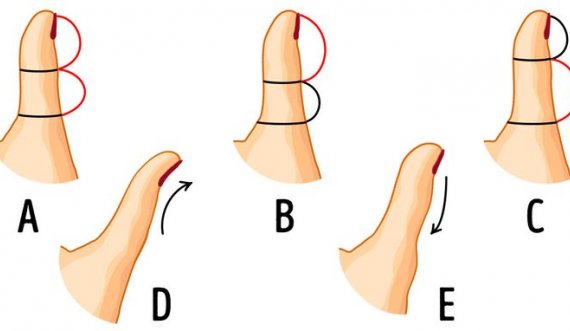 Forma e gishtit të madh të dorës mund të zbulojë shumë për personalitetin tuaj. Ja ç’duhet të dini