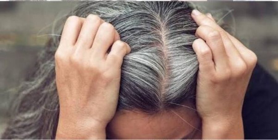 Përse nuk duhet assesi t’i ndukni qimet e thinjura nga flokët?
